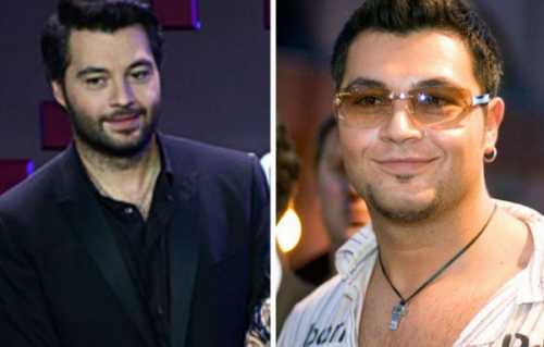 Алексей Чумаков сделал пластическую операцию