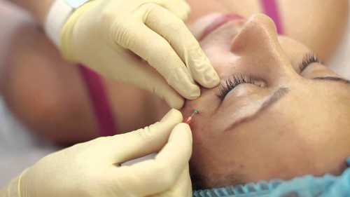 Когда и как использовать интемпоральный лифтинг