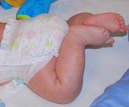 Во время болезни организм, кроме воды, теряет полезные вещества, поэтому ребёнку следует давать напитки, содержащие витамины и микроэлементы