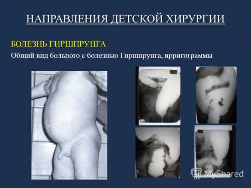 Периодическое вздутие живота