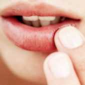 Трещины бывают