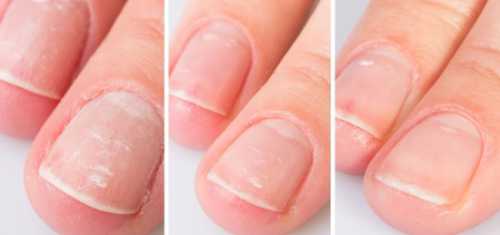 Японский маникюр: преимущества и техника