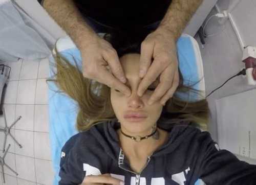 Подписчики подозревают, что Бородина сделала ринопластику