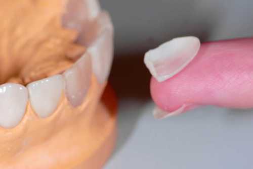 Она прошла путь от полной брюнетки к стройной блондинке с завидными формами