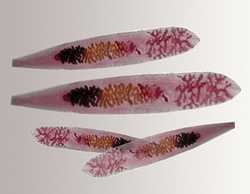 Остановить патологический процесс и предотвратить потерю плода можно, вовремя обратившись к медикам