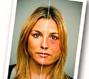 Признаки алкоголизма у женщин