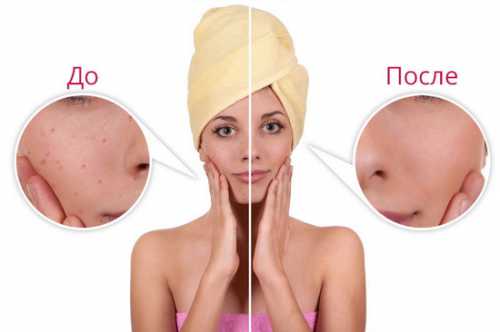 Женское мнение: Оливье по