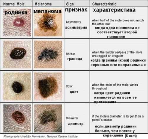 5 и 1 способ отличить притворство