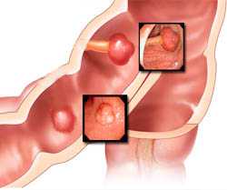 Можно приготовить с барсучьим жиром питательный ночной крем для сухой кожи