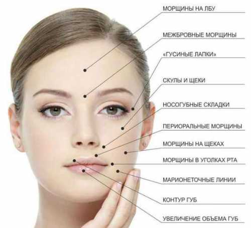 Контурная пластика