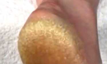 Картофельная ванночка готовится из крахмала, который тоже оказывает благотворительное влияние на кожу