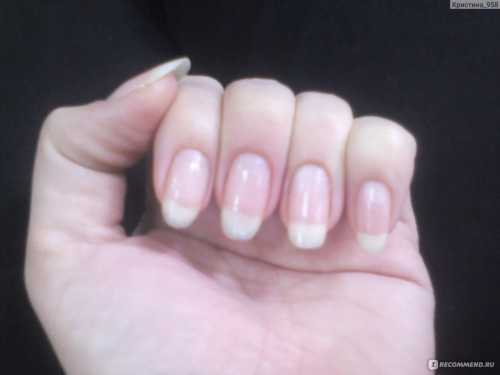 Шаг к ухоженным и здоровым ногтям